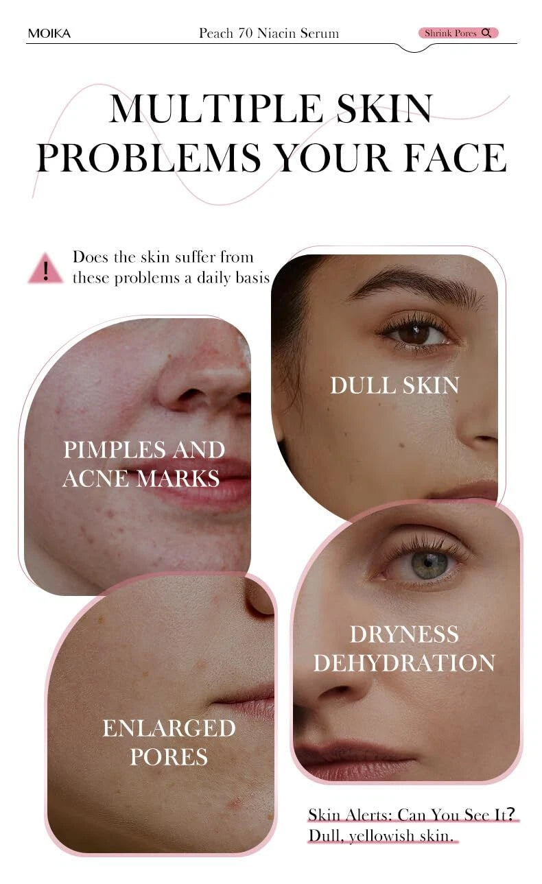 Anua Peach 70 + Niacin Serum 30 ml – Brightening Korean Peach Extract Serum with 5% Niacinamide